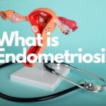 What is Endometriosis